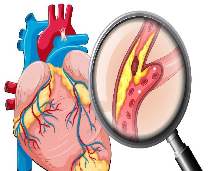THẢI ĐỘC TIM ĐƠN GIẢN DỄ ÁP DỤNG