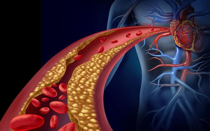 7 NGUYÊN NHÂN KHIẾN MỠ MÁU TĂNG CAO