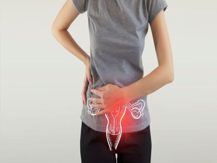 UNG THƯ BUỒNG TRỨNG DỄ TÁI PHÁT VÀ DI CĂN DO QUÁ TRÌNH ĐIỀU TRỊ ĐẠT KẾT QUẢ KHÔNG CAO