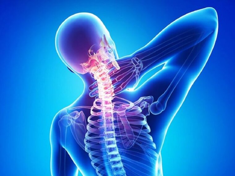 CÁC BÀI THUỐC ĐƠN GIẢN CHỮA ĐAU VAI GÁY HIỆU QUẢ