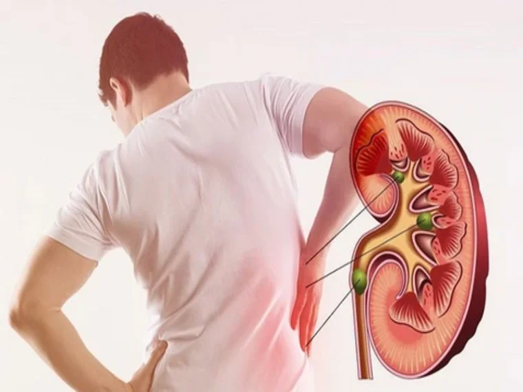 CÁC YẾU TỐ NGUY CƠ BỆNH UNG THƯ THẬN