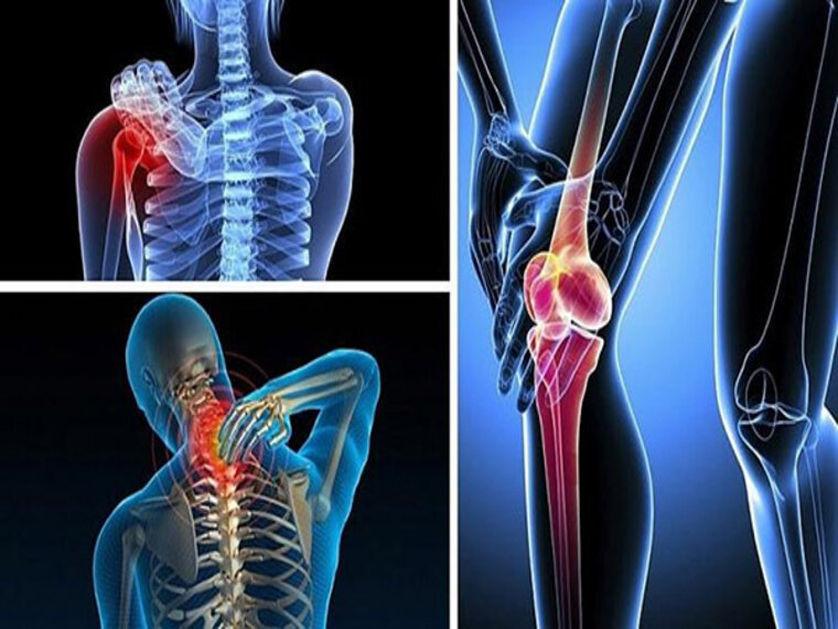 UNG THƯ XƯƠNG GIAI ĐOẠN CUỐI